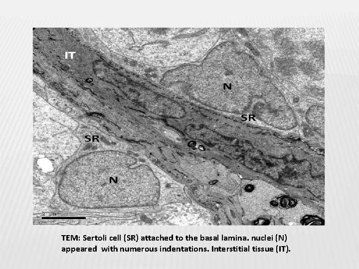 TEM: Sertoli cell (SR) attached to the basal lamina. nuclei (N) appeared with numerous