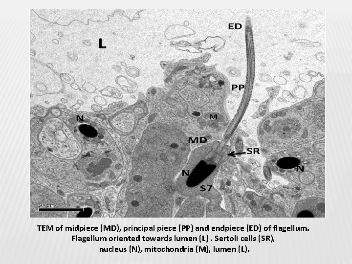 TEM of midpiece (MD), principal piece (PP) and endpiece (ED) of flagellum. Flagellum oriented