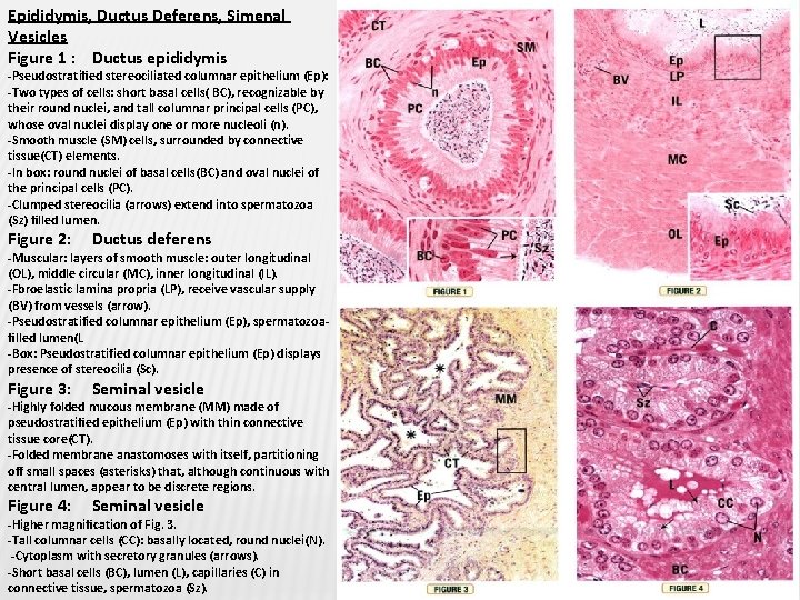 Epididymis, Ductus Deferens, Simenal Vesicles Figure 1 : Ductus epididymis -Pseudostratiﬁed stereociliated columnar epithelium