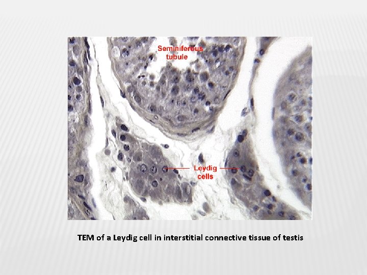 TEM of a Leydig cell in interstitial connective tissue of testis 