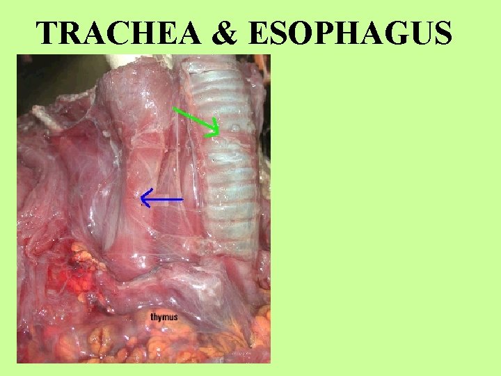 TRACHEA & ESOPHAGUS 