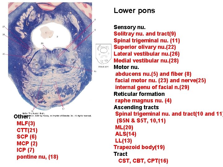 Lower pons Other: MLF(3) CTT(21) SCP (6) MCP (2) ICP (7) pontine nu, (18)