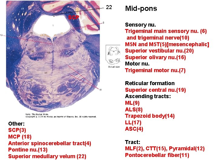 22 Mid-pons SCP Sensory nu. Trigeminal main sensory nu. (6) and trigeminal nerve(10) M