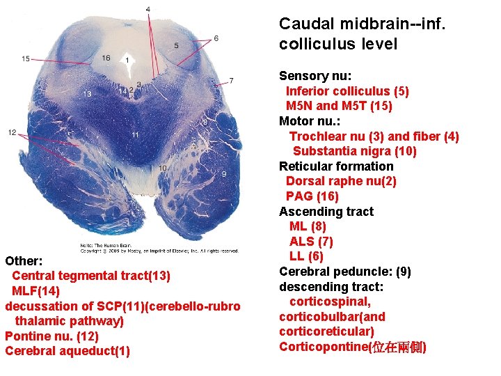 Caudal midbrain--inf. colliculus level Other: Central tegmental tract(13) MLF(14) decussation of SCP(11)(cerebello-rubro thalamic pathway)