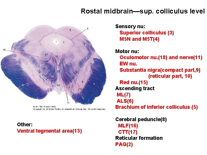 Rostal midbrain—sup. colliculus level Sensory nu: Superior colliculus (3) M 5 N and M