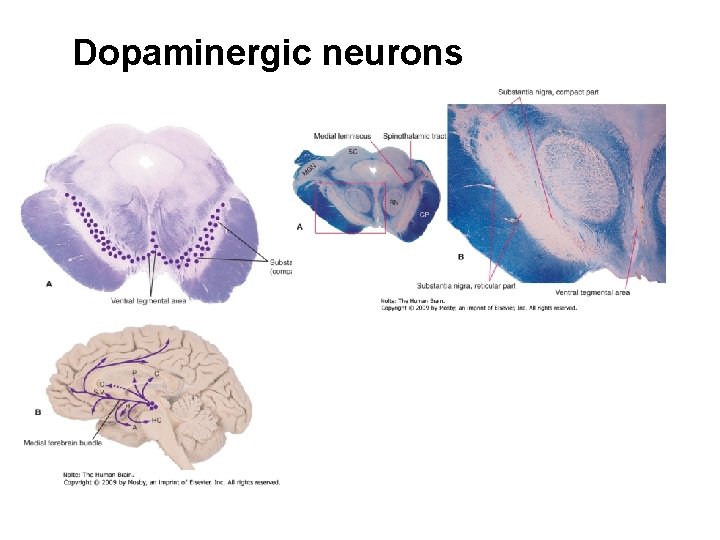 Dopaminergic neurons 