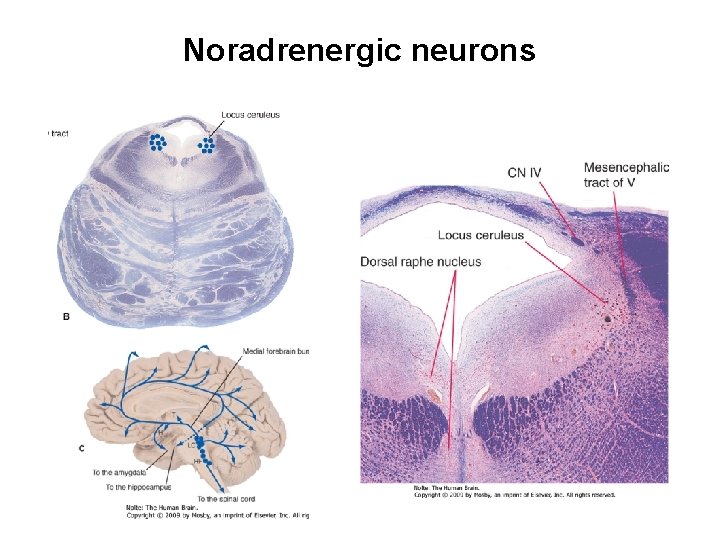 Noradrenergic neurons 