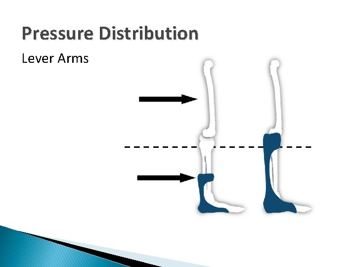 Pressure Distribution Lever Arms 