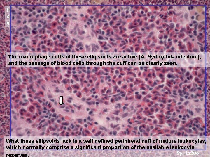 Higher magnification shows the pigmented areas to be melano-macrophage centres. The ellipsoids are thick