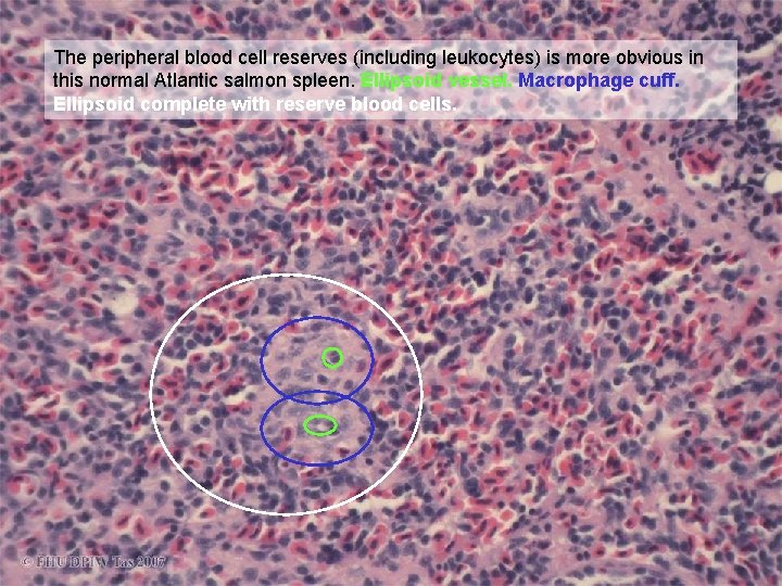 The peripheral blood cell reserves (including leukocytes) is more obvious in this normal Atlantic