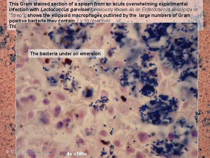 This Gram stained section of a spleen from an acute overwhelming experimental infection with