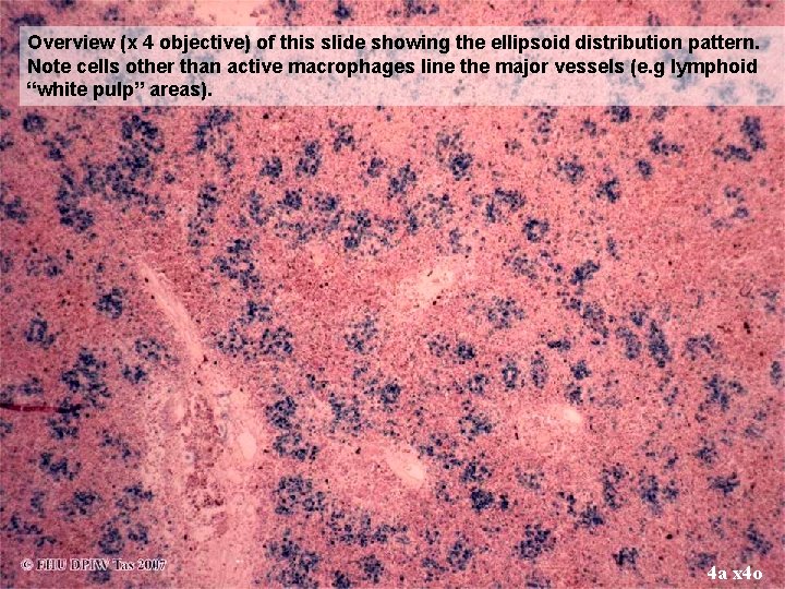 Overview (x 4 objective) of this slide showing the ellipsoid distribution pattern. Note cells