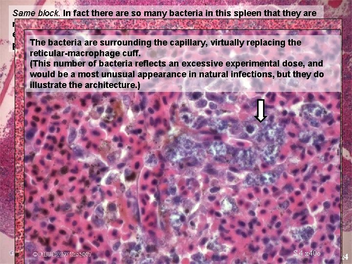 Same block. In fact there are so many bacteria in this spleen that they