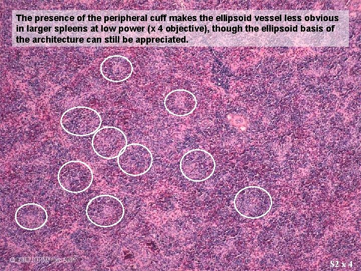 The presence of the peripheral cuff makes the ellipsoid vessel less obvious in larger