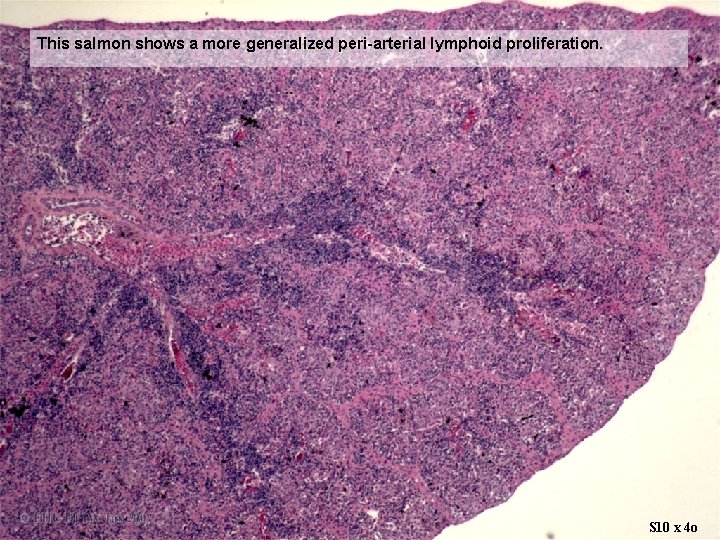 This salmon shows a more generalized peri-arterial lymphoid proliferation. S 10 x 4 o