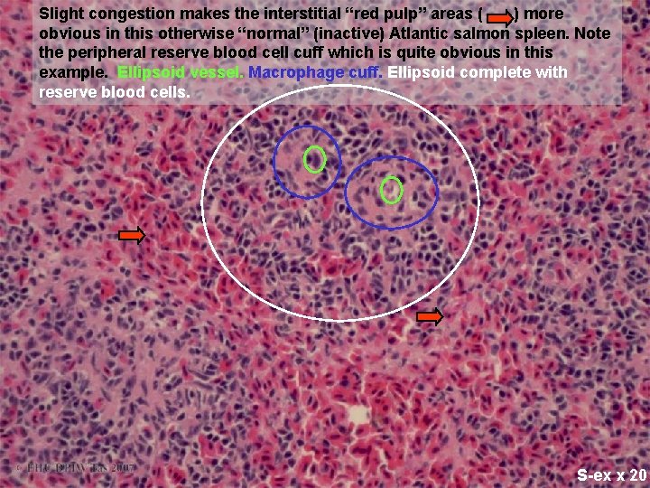 Slight congestion makes the interstitial “red pulp” areas ( ) more obvious in this