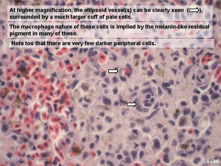 At higher magnification, the ellipsoid vessel(s) can be clearly seen ( surrounded by a