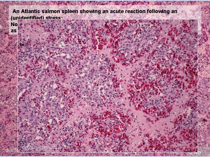 An Atlantic salmon spleen showing an acute reaction following an (unidentified) stress: Note the