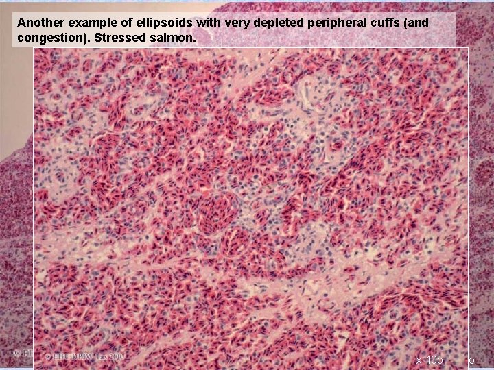 Another example of ellipsoids with very depleted peripheral cuffs (and congestion). Stressed salmon. S
