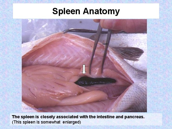 Spleen Anatomy The spleen is closely associated with the intestine and pancreas. (This spleen