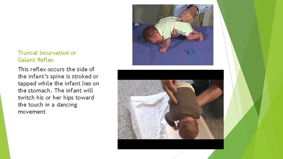 Truncal Incurvation or Galant Reflex This reflex occurs the side of the infant’s spine