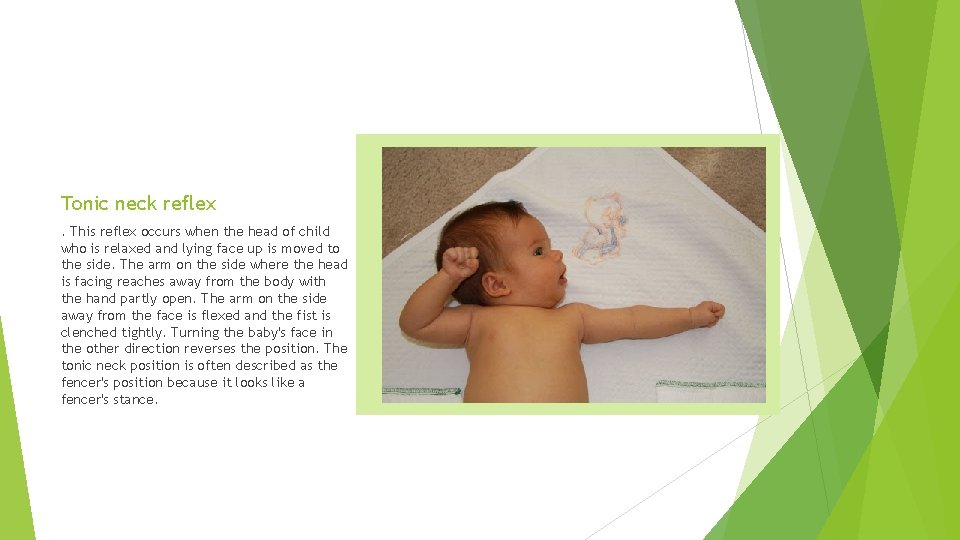 Tonic neck reflex. This reflex occurs when the head of child who is relaxed