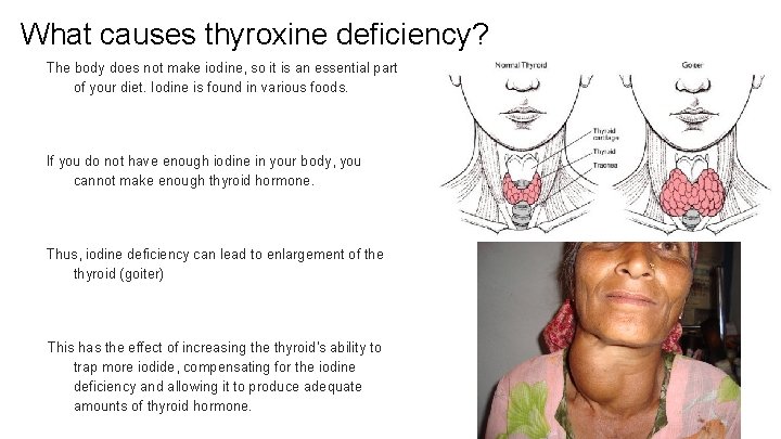 What causes thyroxine deficiency? The body does not make iodine, so it is an