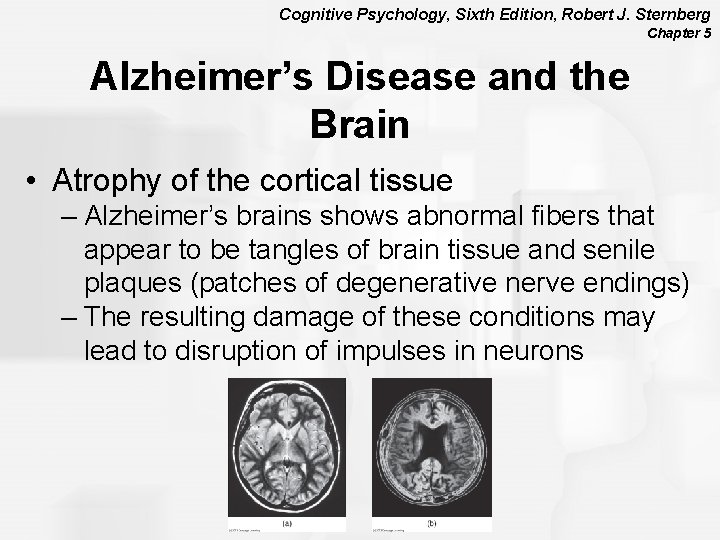 Cognitive Psychology, Sixth Edition, Robert J. Sternberg Chapter 5 Alzheimer’s Disease and the Brain