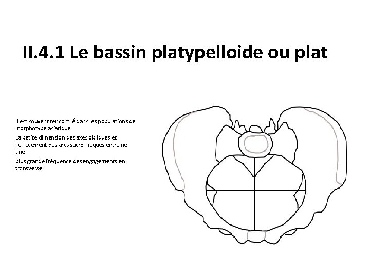 II. 4. 1 Le bassin platypelloide ou plat Il est souvent rencontré dans les