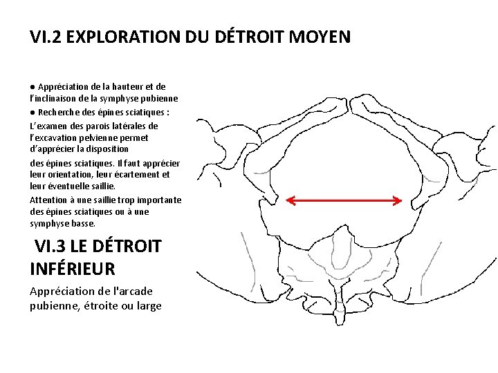 VI. 2 EXPLORATION DU DÉTROIT MOYEN ● Appréciation de la hauteur et de l’inclinaison