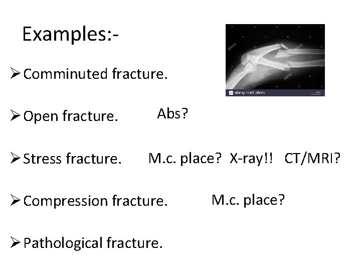 Examples: Ø Comminuted fracture. Ø Open fracture. Ø Stress fracture. Abs? M. c. place?