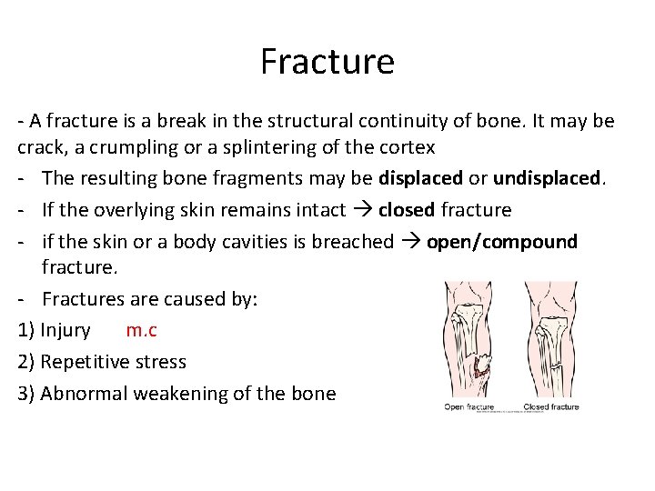 Fracture - A fracture is a break in the structural continuity of bone. It