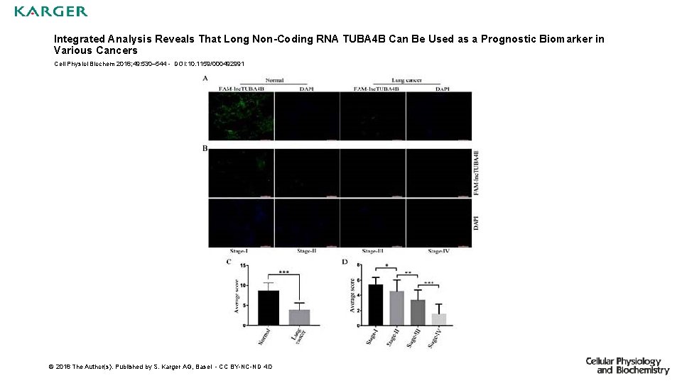 Integrated Analysis Reveals That Long Non-Coding RNA TUBA 4 B Can Be Used as