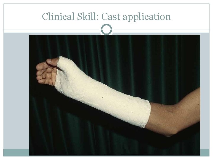 Clinical Skill: Cast application 
