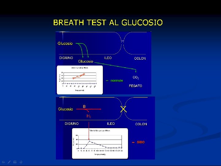 BREATH TEST AL GLUCOSIO Cause dei risultati falsi negativi Ø assenza di batteri che