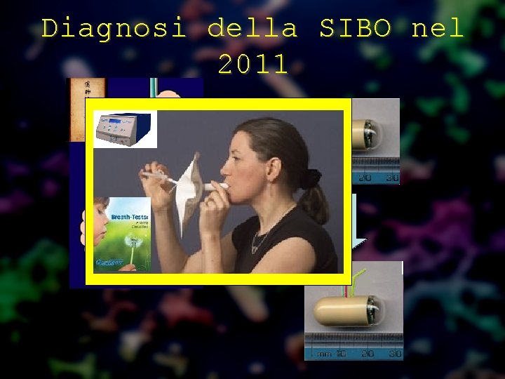 Diagnosi della SIBO nel 2011 