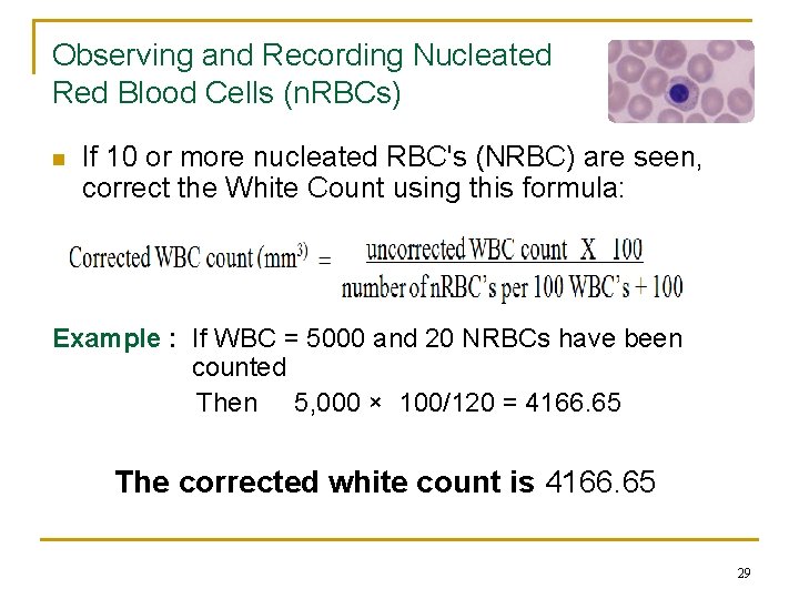 Observing and Recording Nucleated Red Blood Cells (n. RBCs) n If 10 or more