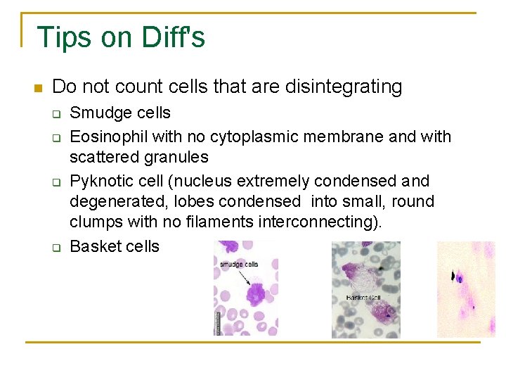 Tips on Diff's n Do not count cells that are disintegrating q q Smudge