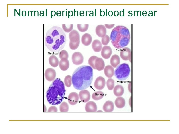 Normal peripheral blood smear 