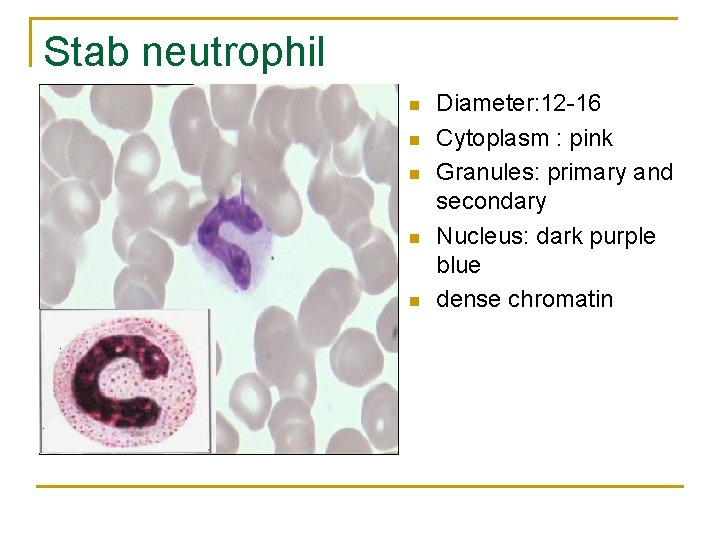 Stab neutrophil n n n Diameter: 12 -16 Cytoplasm : pink Granules: primary and