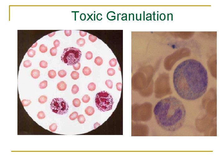 Toxic Granulation 