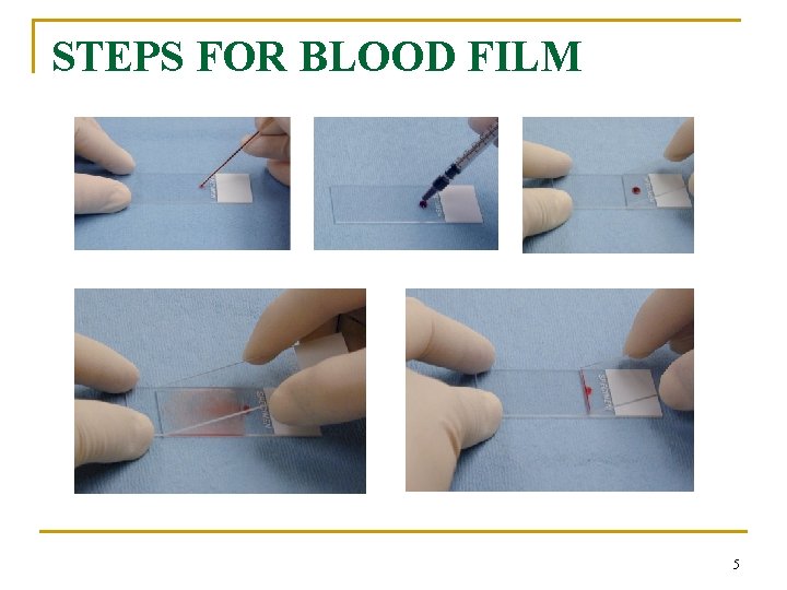 STEPS FOR BLOOD FILM 5 