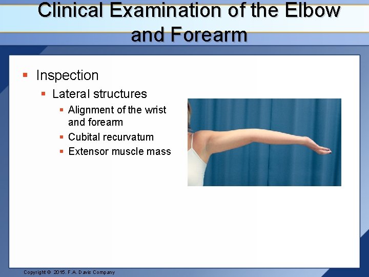 Clinical Examination of the Elbow and Forearm § Inspection § Lateral structures § Alignment