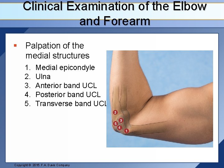 Clinical Examination of the Elbow and Forearm § Palpation of the medial structures 1.