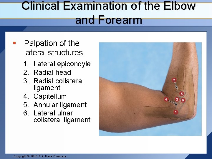Clinical Examination of the Elbow and Forearm § Palpation of the lateral structures 1.