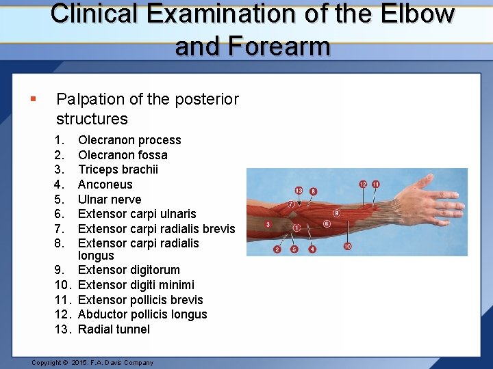Clinical Examination of the Elbow and Forearm § Palpation of the posterior structures 1.