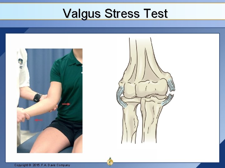 Valgus Stress Test Copyright © 2015. F. A. Davis Company 
