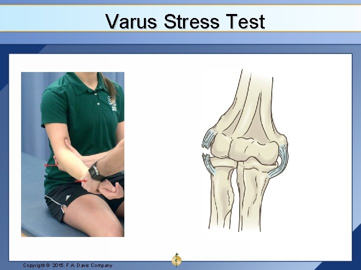 Varus Stress Test Copyright © 2015. F. A. Davis Company 