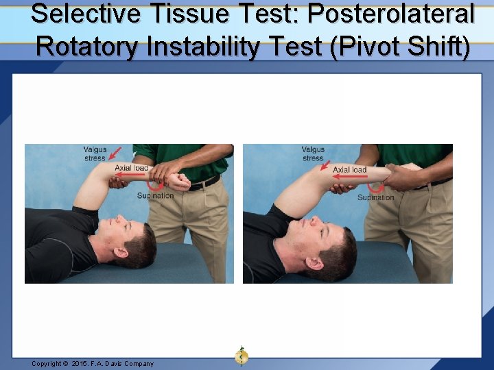 Selective Tissue Test: Posterolateral Rotatory Instability Test (Pivot Shift) Copyright © 2015. F. A.