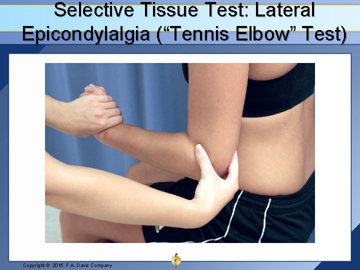 Selective Tissue Test: Lateral Epicondylalgia (“Tennis Elbow” Test) Copyright © 2015. F. A. Davis